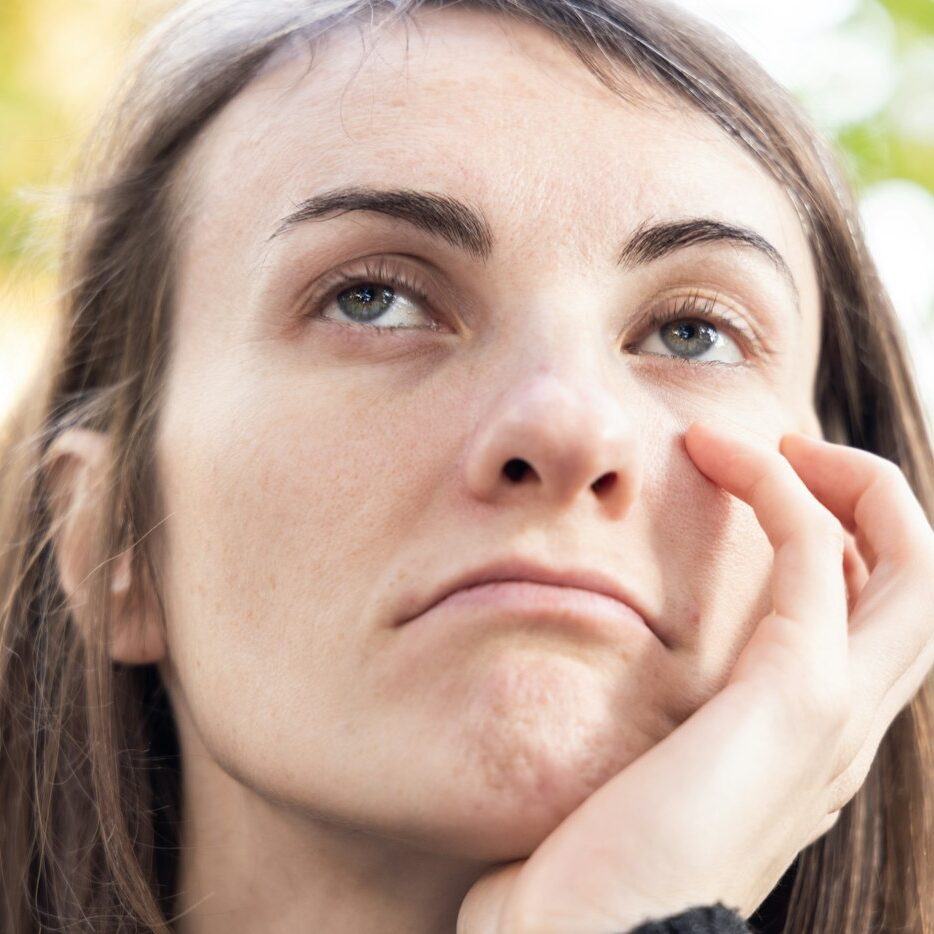 Woman concerned about acne breakouts before laser acne treatment