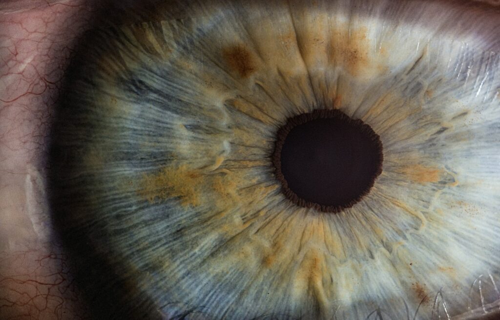 Close-up of an upper eyelid and brow area | LightTouch Med Spa Close-up of an upper eyelid and brow area