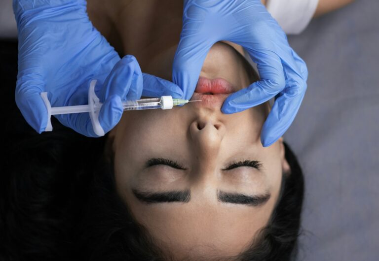 Close-up of natural-looking lips after 0.5 mL lip filler