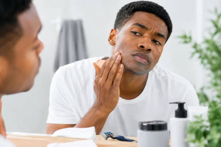 How to Treat Razor Bumps and Prevent Them