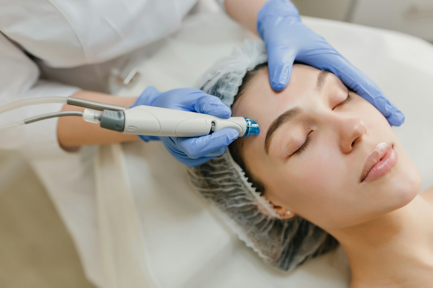 Provider performing a skin resurfacing treatment for scars in Orlando