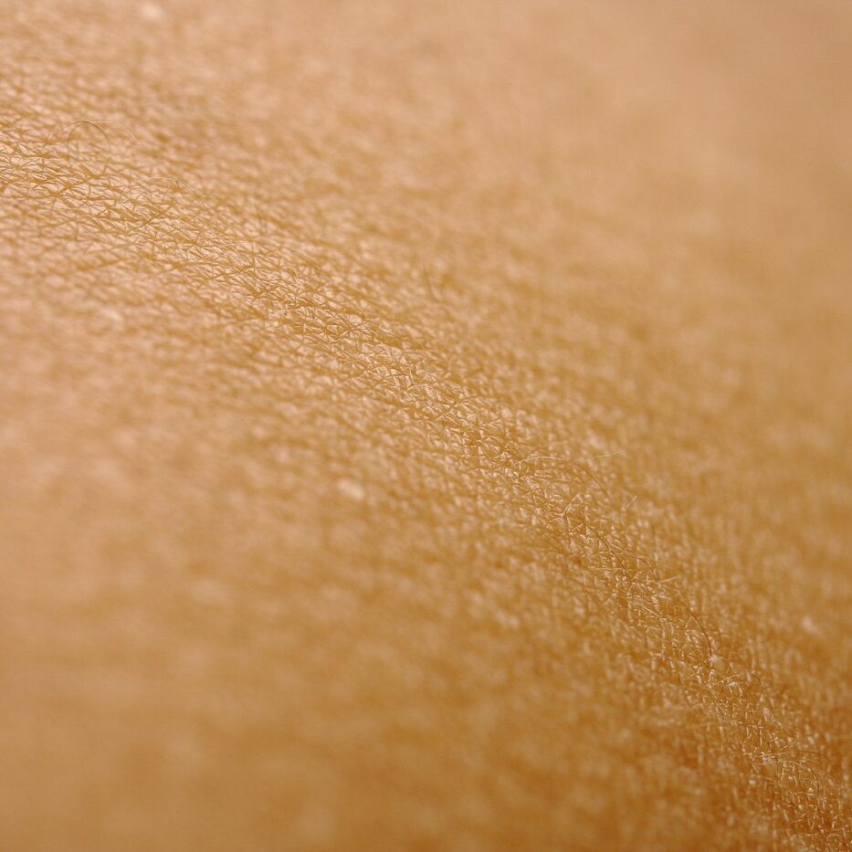 Close-up of skin texture improved with laser scar resurfacing