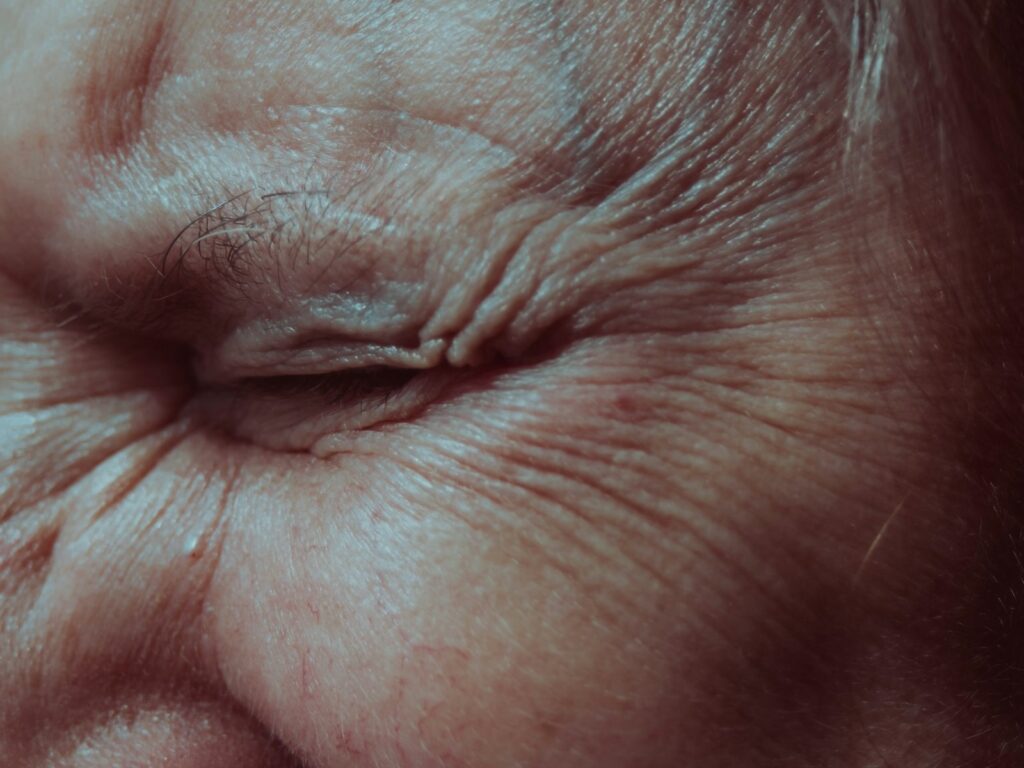 Close-up of forehead lines on a relaxed face | LightTouch Med Spa Close-up of forehead lines on a relaxed face